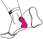 Achilles Heel Pad - Gel and Fabric - Silipos Gel / Achilles Heel Pad Sleeve (EC 8 Achilles) — Dr. Jill’s Foot Pads