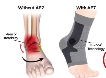 Ankle Bracing Sleeve — view 2