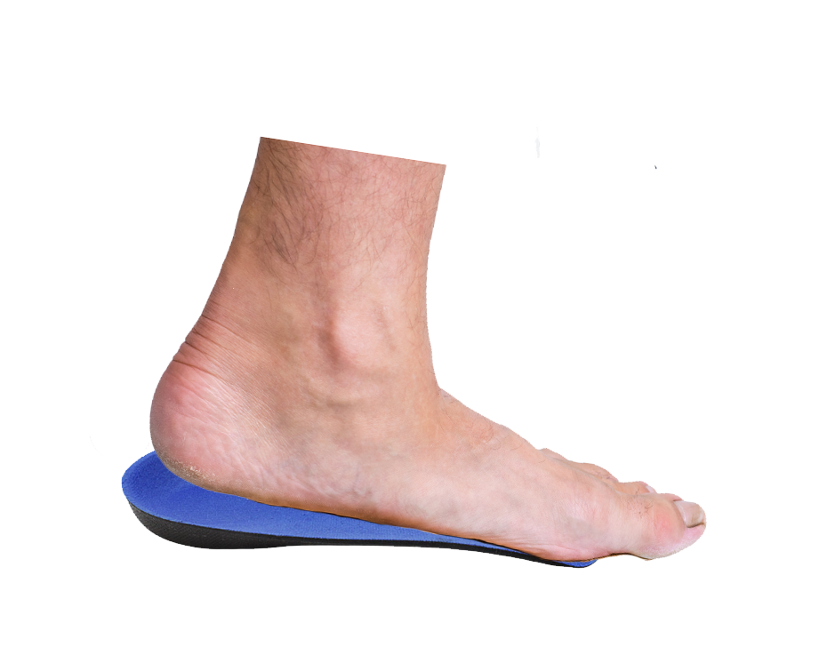 Arch Steppers — view 2