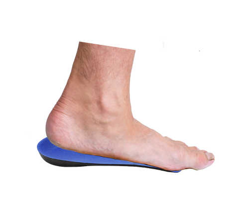 Arch Steppers — view 2