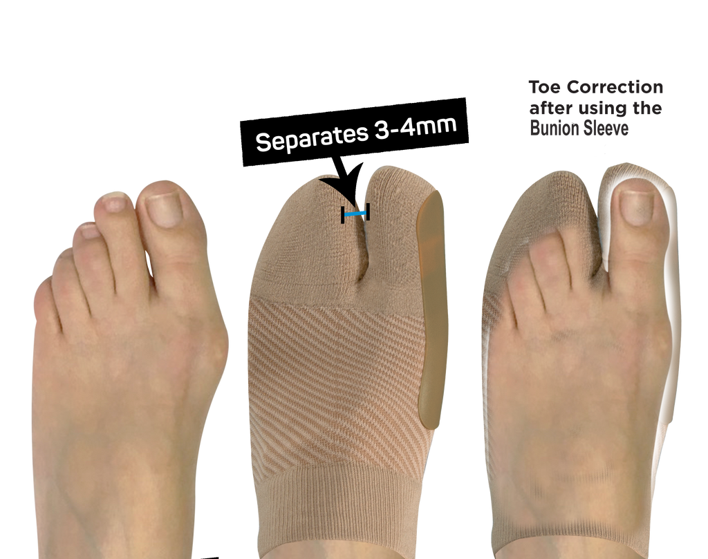 Bunion Bracing Sleeve — view 5
