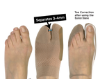 Bunion Bracing Sleeve — view 5