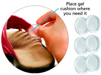 Clear Gel Pressure Points (C-4 PP)