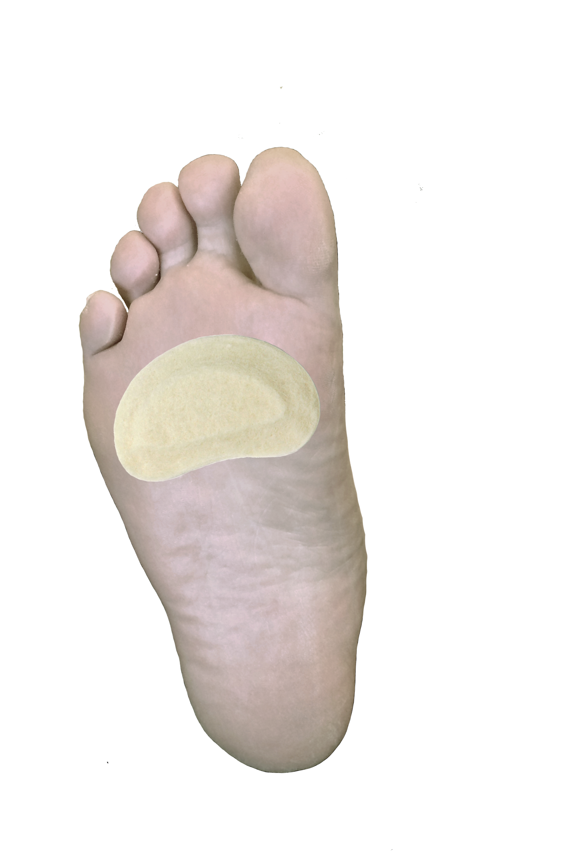 Kidney Pad J-15 / Kidney Pad J-16 — Dr. Jill’s Foot Pads