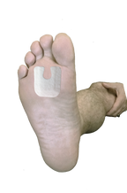 Callus / Lesion Pad J-18