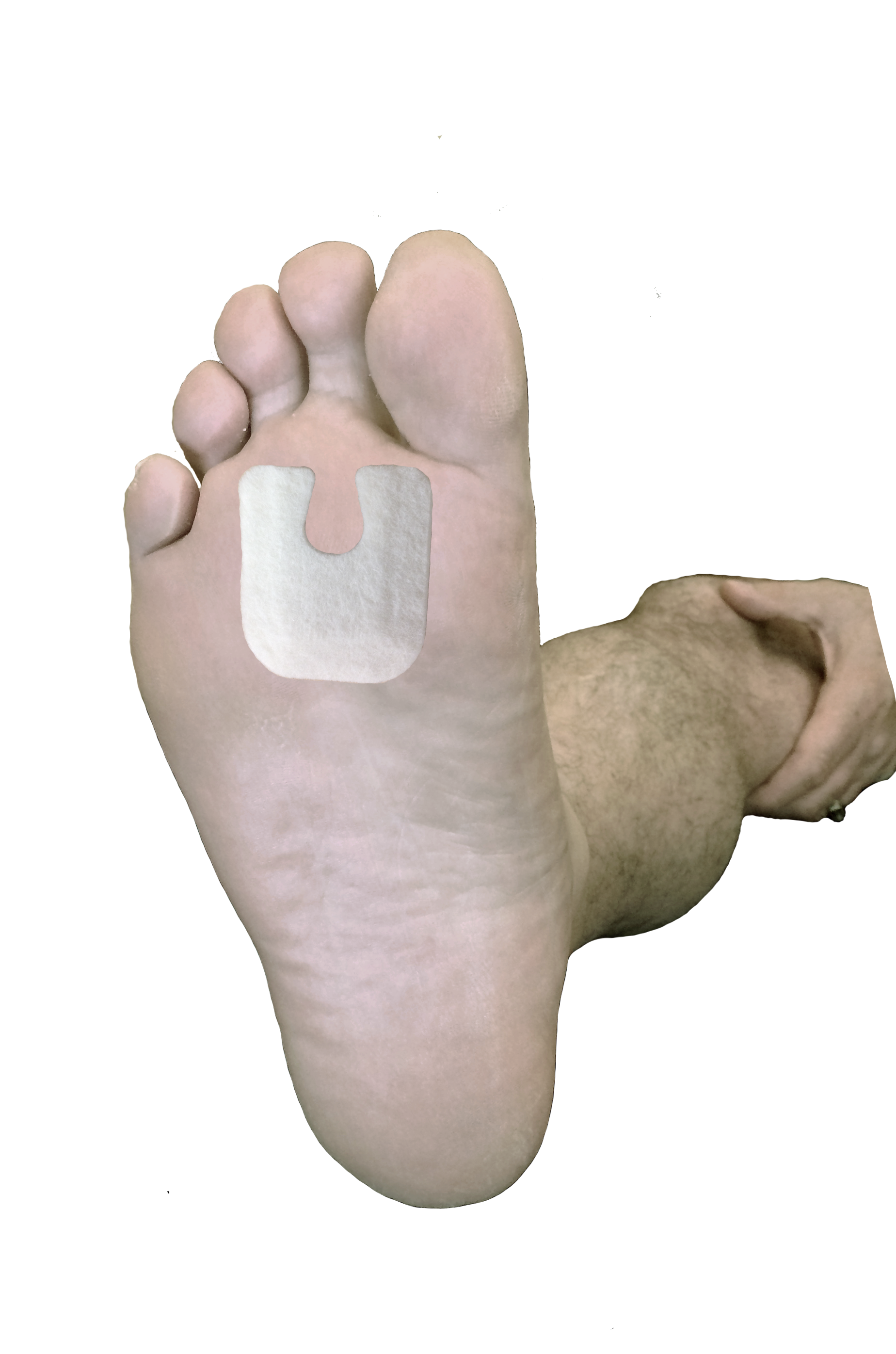 Callus / Lesion Pad J-18