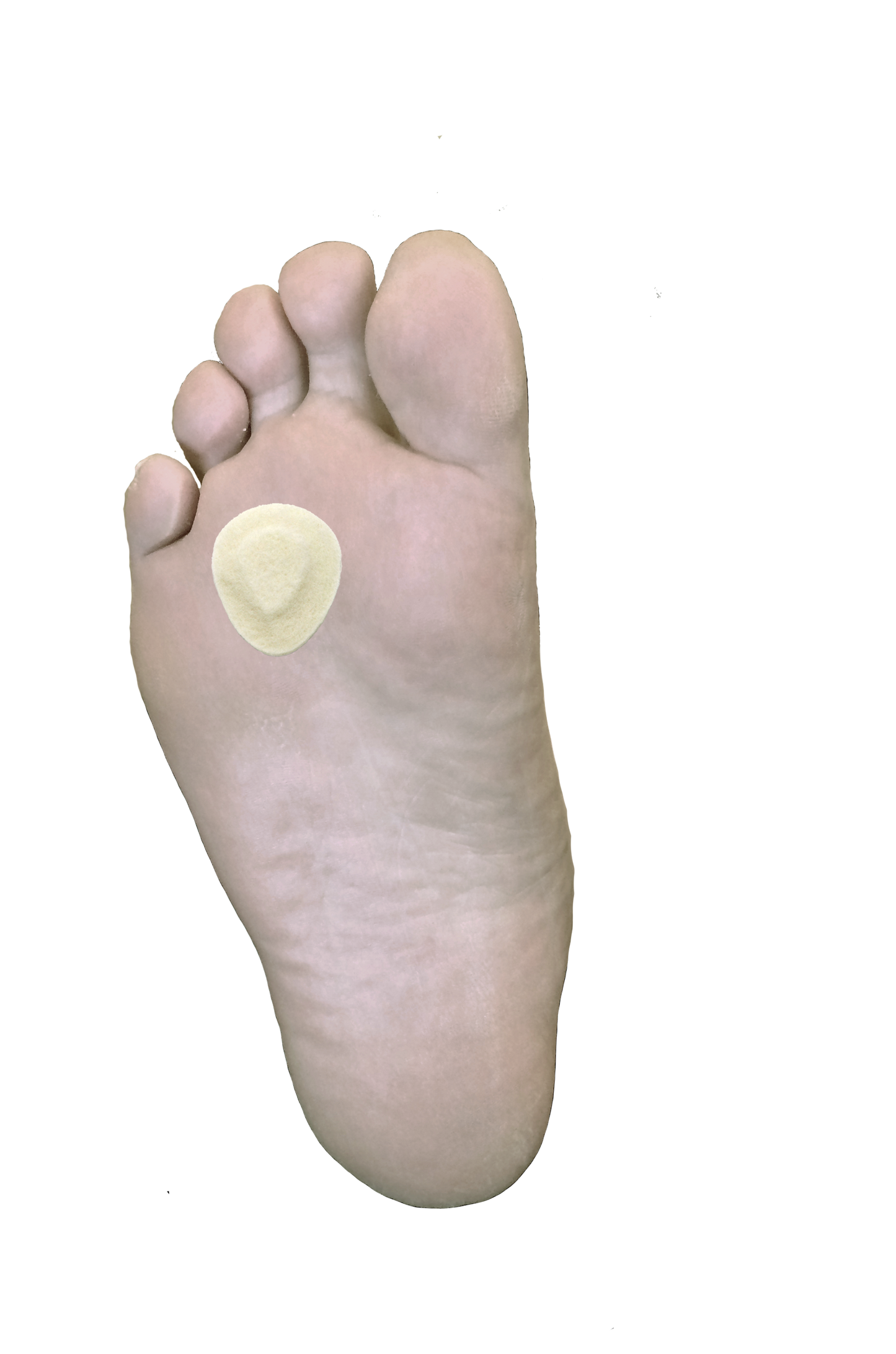 Small Metatarsal / Neuroma Pad J-43