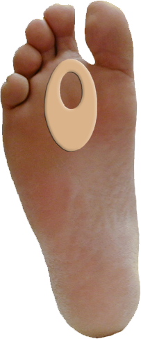 Callus / Lesion Pad J-9 — view 11