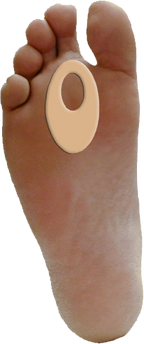 Callus / Lesion Pad J-9 — view 11