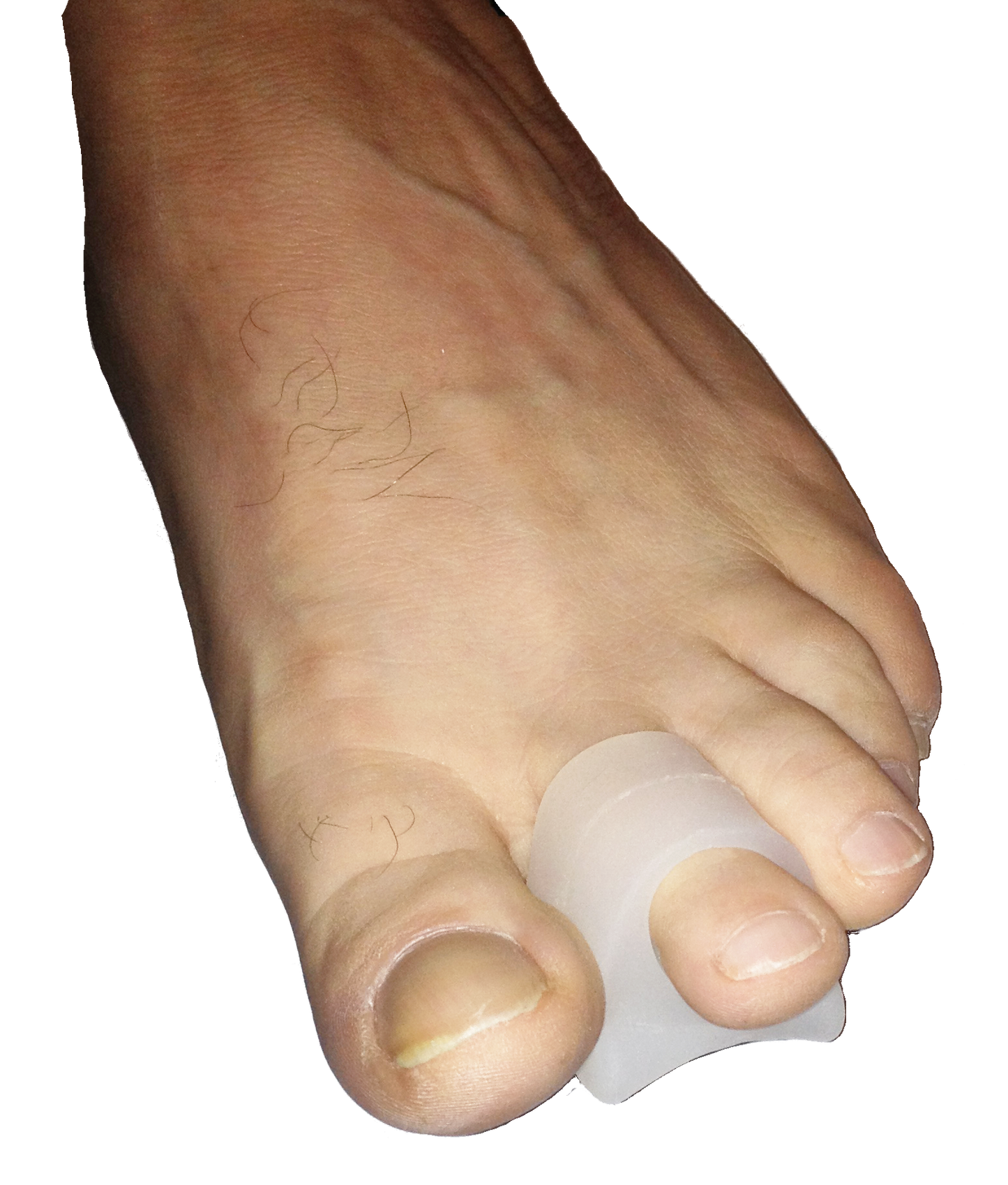 P-1 Loop - Spreader with Loop (aka 1 Toe Crest Pad)