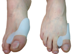 Spreader with Bunion Combo