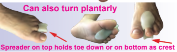 Spreader with Bunion Combo