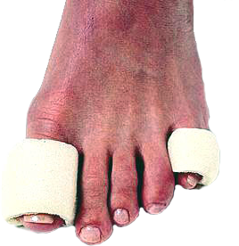 Tubefoam Toe Tubes - aka Pedifoam