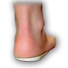 Warwick Heel Wedge — view 2